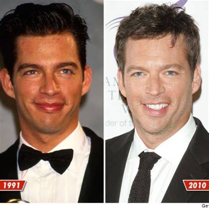 Did Harry Connick Jr. Have a Stroke? Understanding His Health Journey