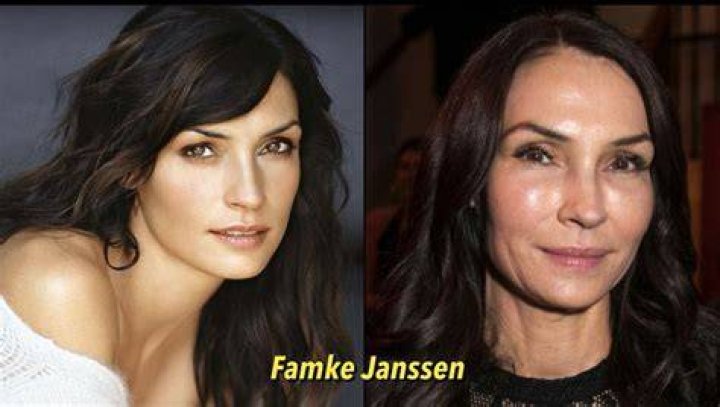 Famke Janssen Plastic Surgery: Exploring the Truth Behind the Transformation