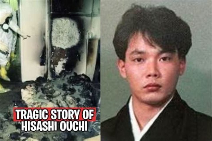 Hisashi Ouchi Body Photo: The Tragic Story Behind the Iconic Image