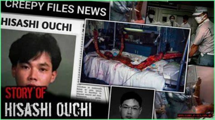 Hisashi Ouchi Photos: A Closer Look at the Hospitalization Journey