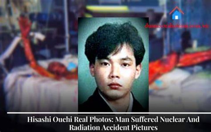 Hisashi Ouchi Pictures: The Real Story Behind the Infamous Incident