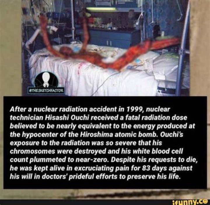 Hisashi Ouchi: The Tragic Story of the Nuclear Accident Victim