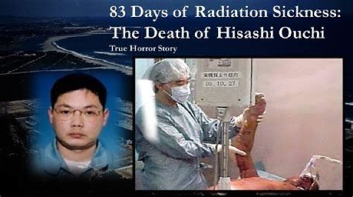 Hisashi Ouchi: The Truth Behind the Real Pictures