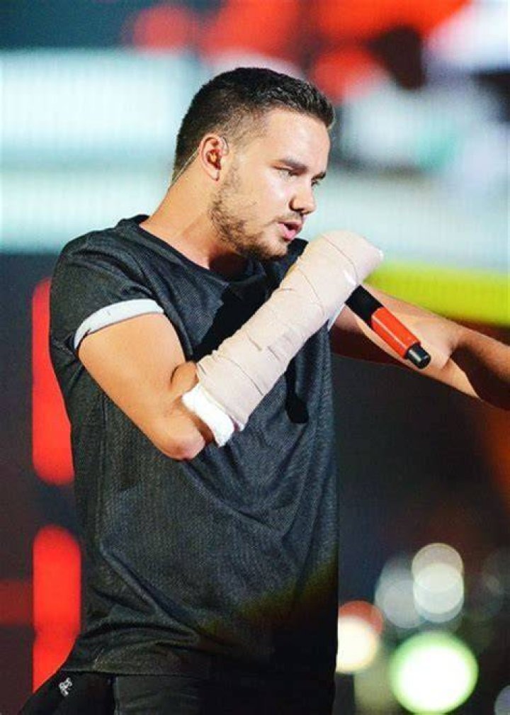 Liam Payne's Broken Arm: A Journey Through Recovery