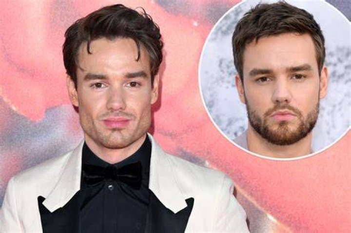 Liam Payne's Journey Through Jaw Surgery: A Story of Resilience and Recovery