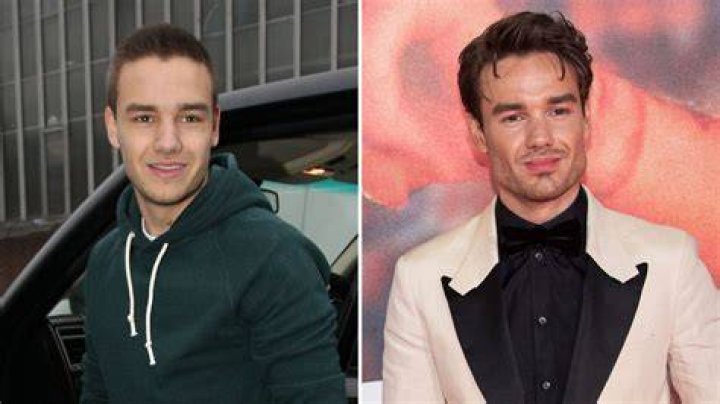 Liam Payne's Transformation: The Nose Job Journey