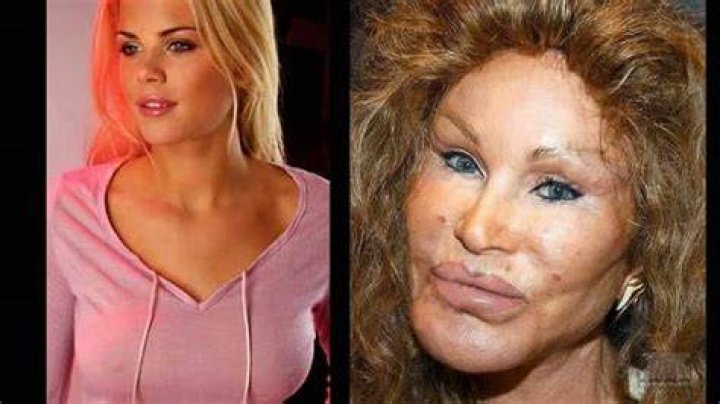 Transformations of Jocelyn Wildenstein: A Deep Dive into Her Journey