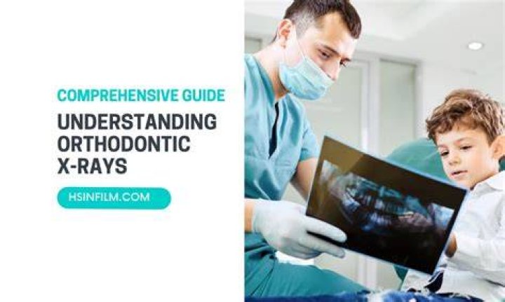 Understanding Infant Teeth X-Rays: A Comprehensive Guide