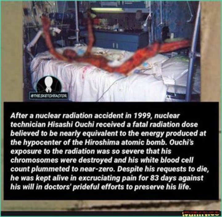 Understanding the Hisashi Nuclear Accident: A Comprehensive Analysis