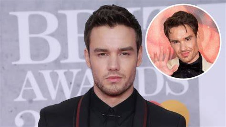 Unveiling the Mystery: Liam Payne’s Face Lift Transformation