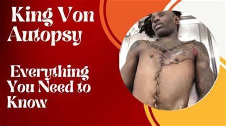 Unveiling the Truth: King Von's Autopsy Pic and Its Impact